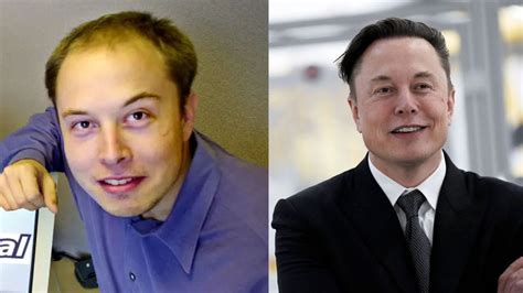 Has Elon Musk Had Plastic Surgery? Exploring the Speculations and Realities